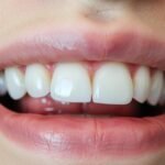 Do Zyns Cause Gum Recession